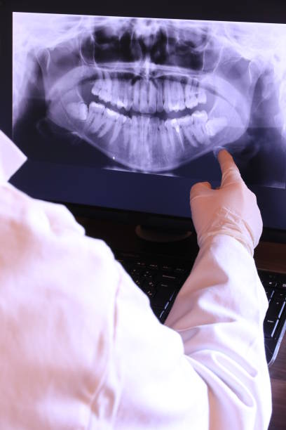 Best Emergency Root Canal Treatment in Jackson Center, OH